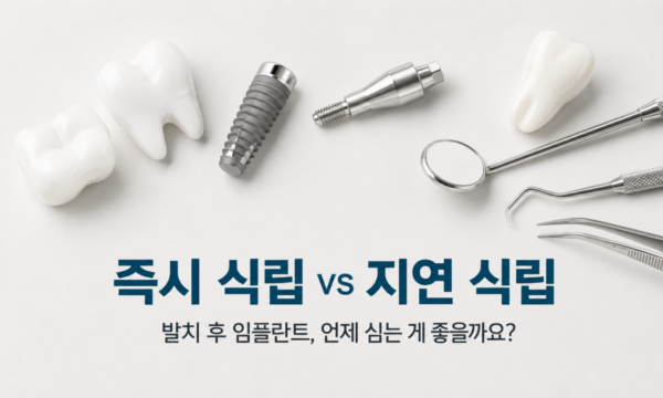 이를 뽑고 임플란트, 바로 해도 될까요? — 즉시·조기·지연 식립, 내 케이스에 맞는 선택은? | 강서구 방화동 서울곧은치과